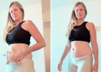 Susana Werner inicia tratamento com caneta emagrecedora e expõe luta contra a balança