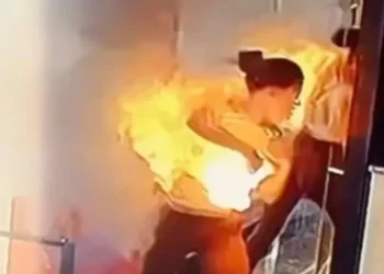 Influenciadora sofre queimaduras graves após carregador explodir; vídeo