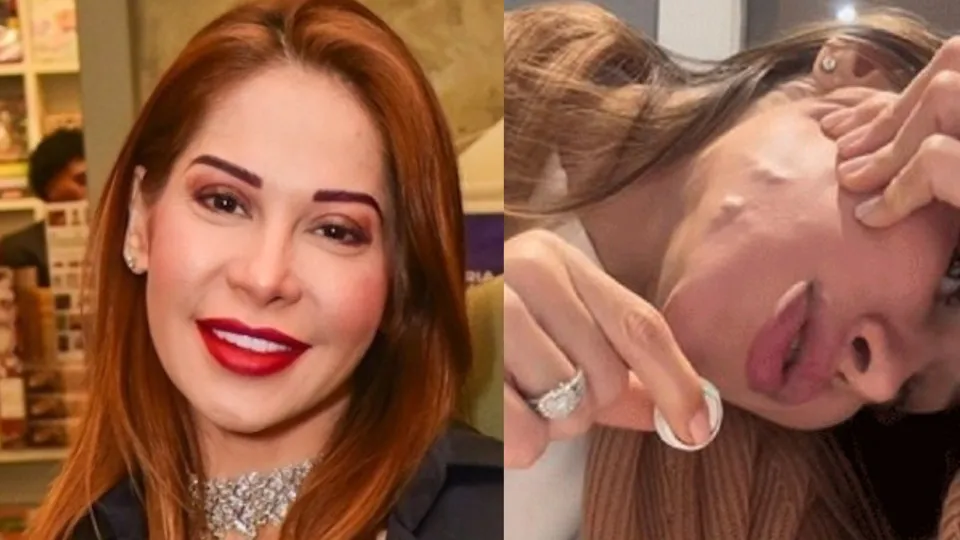 Famosas admitem seus maiores arrependimentos de beleza: