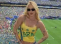 Celebridades que sofrem de alopecia e podem ficar carecas
