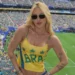Celebridades que sofrem de alopecia e podem ficar carecas