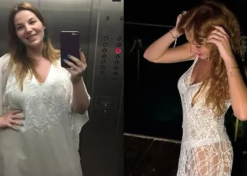 Luiza Zveiter recorda sequelas após bariátrica