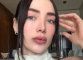 Influenciadora mexicana morre aos 30 após cirurgia plástica