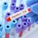 Mortalidade por hepatite viral atinge 1 a cada 5 pacientes com 80 anos no SUS