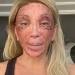 'Não consigo nem rir', diz Maya Massafera mostra rosto inchado após peeling e ironiza reação: 'Não consigo nem rir'