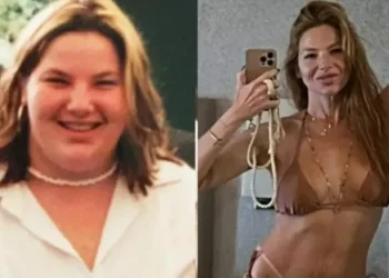 Irreconhecível: Repórter da Globo perde 70kg e 8 dentes após bariátrica