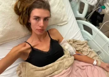Modelo fala sobre internação em estado grave por anorexia