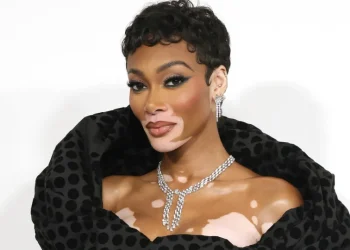 Famosos que sofrem de vitiligo: