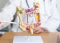 Pacientes com câncer colorretal têm medicamento aprovado pela Anvisa
