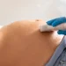 Cirurgia inédita corrige malformação em bebê ainda no útero da mãe