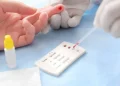 Estudo em Porto Alegre mostra que diagnóstico tardio de HIV ocorre mais em heterossexuais casados
