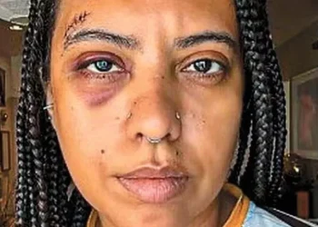 Influenciadora leva seis pontos após agressão em roda de samba no Rio