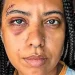 Influenciadora leva seis pontos após agressão em roda de samba no Rio