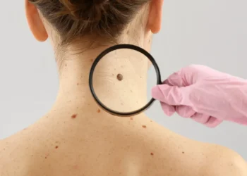 Moderna e Merck anunciam sucesso de vacina experimental com mRNA contra recidiva do melanoma