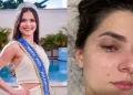 Empresário é condenado por agredir ex-Miss Universo após crise de ciúmes
