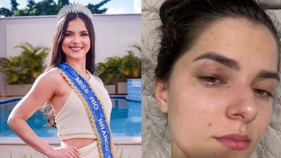Empresário é condenado por agredir ex-Miss Universo após crise de ciúmes