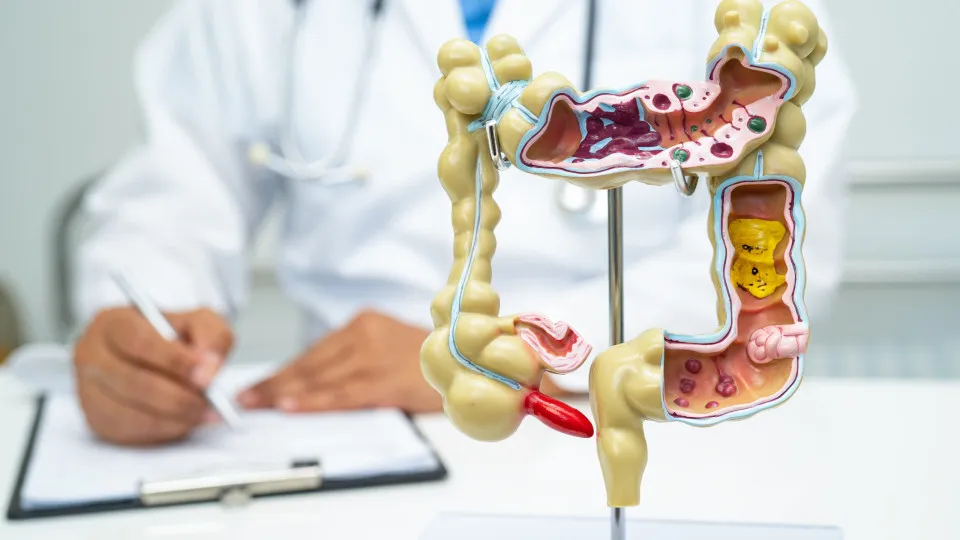 Em 13 anos, doença inflamatória intestinal cresce 5 vezes no Brasil