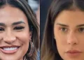 Como ela ficou assim? Os procedimentos estéticos que as famosas fizeram