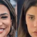 Como ela ficou assim? Os procedimentos estéticos que as famosas fizeram