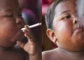 Lembra dele? Veja como ficou o menino que fumava 40 cigarros por dia