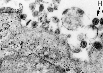 Vírus HTLV-1 causa síndrome inflamatória em assintomáticos, aponta estudo