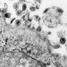 Vírus HTLV-1 causa síndrome inflamatória em assintomáticos, aponta estudo