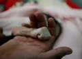 Conflito no Iêmen: ONU aponta recorde de pessoas passando fome