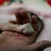 Conflito no Iêmen: ONU aponta recorde de pessoas passando fome