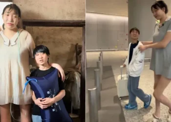Quem era Xiao Yue, influenciadora com mais de dois metros de altura que morreu aos 26 anos